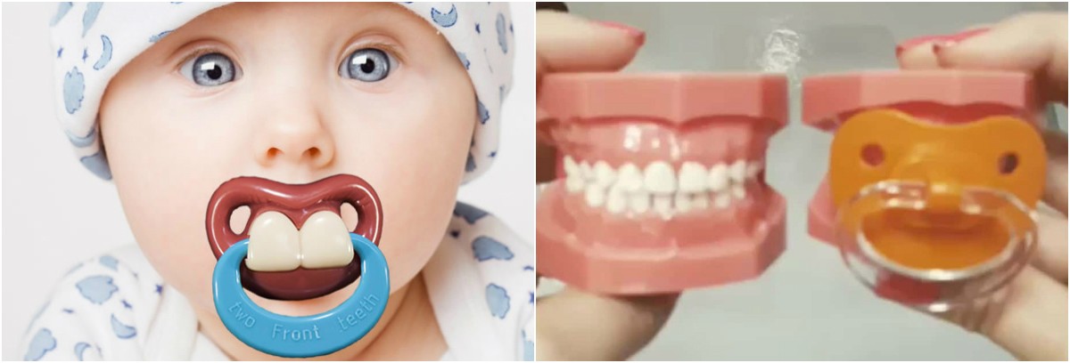 O efeito que as chupetas fazem nos dentes das crianças - Jornal Diário ...