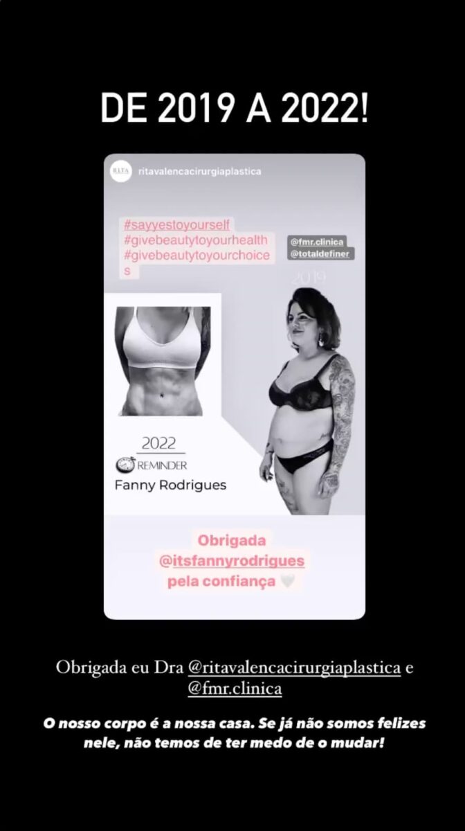 Fanny Rodrigues impressiona ao mostrar o antes e o depois do seu corpo Jornal Diário Online