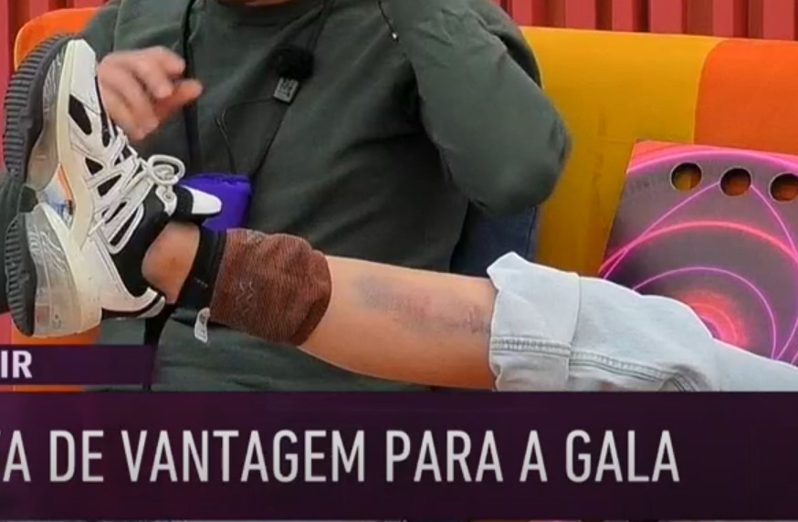 Após acidente no Big Brother, Catarina Miranda mostra estado da perna